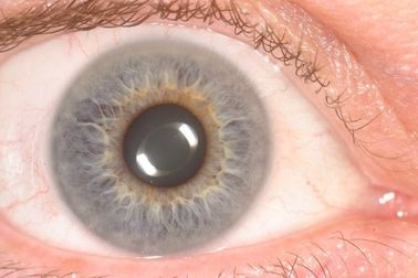 휴대용 세륨 건강을 위한 소형 눈 홍채 스캐너 해석기는 검출합니다