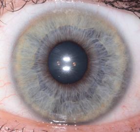 휴대용 세륨 건강을 위한 소형 눈 홍채 스캐너 해석기는 검출합니다
