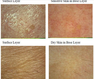 피부 Mositure/윤활제/주름/염색을 위한 얼굴 Uv 피부 해석기 기계