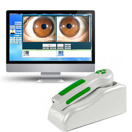 12 MP 고해상도 USB 디지털 홍채학 눈 이리스코프 몸 건강 분석기