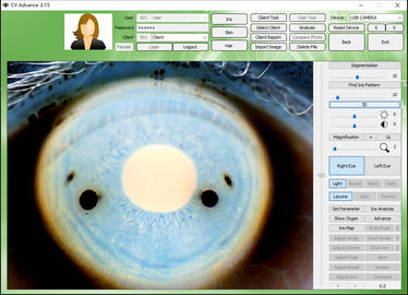 12.0MP 디지털 방식으로 Iriscope Iridology 사진기 눈 시험기 CE/DHL 승인