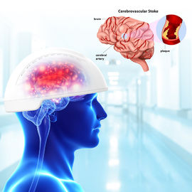 외상성 뇌손상 뇌 Photobiomodulation 장치 810nm 파장
