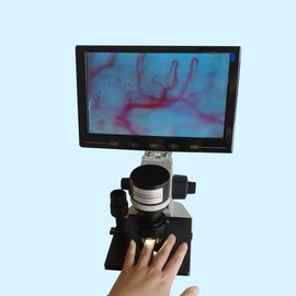 LCD 디스플레이 색깔 미세 혈관 시험 기계 임상 병원 가정