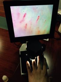 세륨 못 검사를 위한 승인되는 OEM LCD 스크린 색깔 미세 혈관 현미경